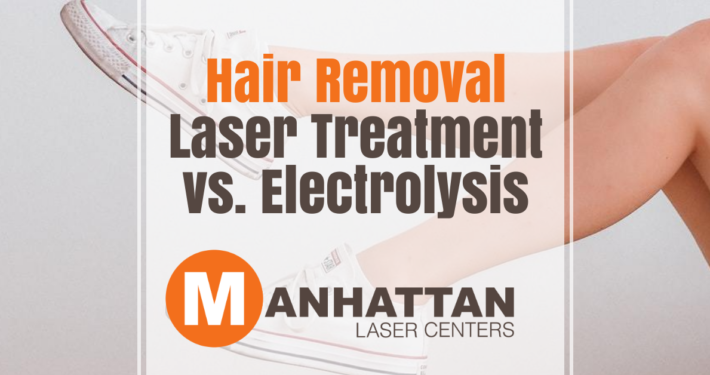 Hair Removal Laser Treatment vs. Electrolysis