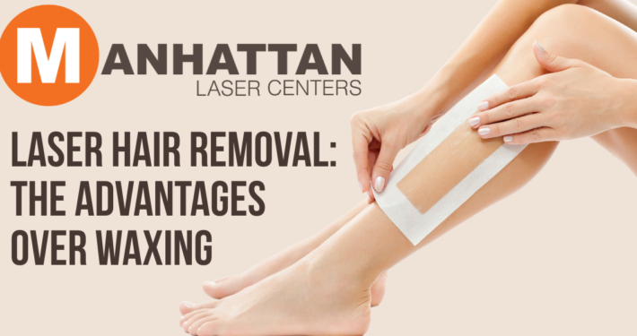 Laser Hair Removal: The Advantages Over Waxing