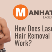 Laser Hair Removal