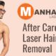 After Care for Laser Hair Removal