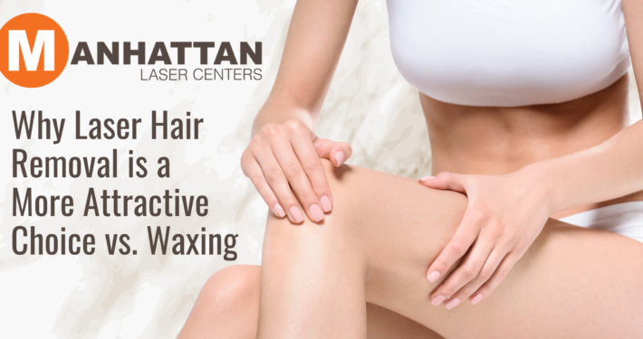 Why Laser Hair Removal is a More Attractive Choice vs. Waxing