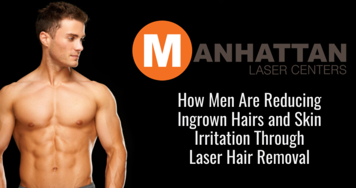 How Men Are Reducing Ingrown Hairs