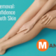 Laser Hair Removal_ Boosting Confidence Through Smooth Skin