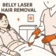 Manhattan's Guide to Belly Laser Hair Removal for Women 2 Image January 12 2026 11 03 AM