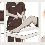 Best Practices for Men's Full Legs Laser Hair Removal in Manhattan 10 Image February 16 2026 11 02 AM