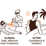 7 Reasons Manhattan Men Choose Back & Shoulders Laser Hair Removal 7 Image March 9 2026 11 03 AM